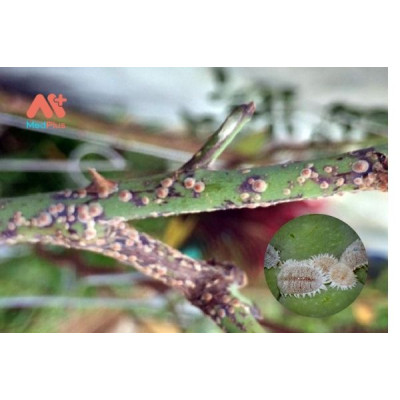 Thuốc Pesieu Đặc Trị Sâu, Ốc Rầy, Nhện Đỏ, Bọ Trĩ Thuốc Pesieu Đặc Trị Sâu, Ốc Rầy, Nhện Đỏ, Bọ Trĩ